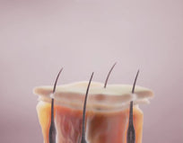 Depiladora Permanente IPL PRO