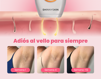 Depiladora Permanente IPL clásica