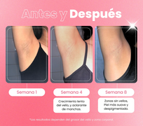 Depiladora Permanente IPL clásica