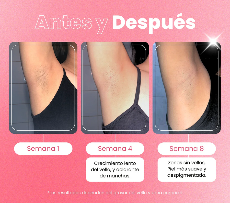 Depiladora Permanente IPL clásica