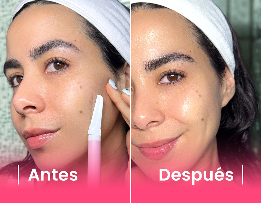 Repuestos de Acero Inoxidable para Perfiladora ShinnySkin reutilizable