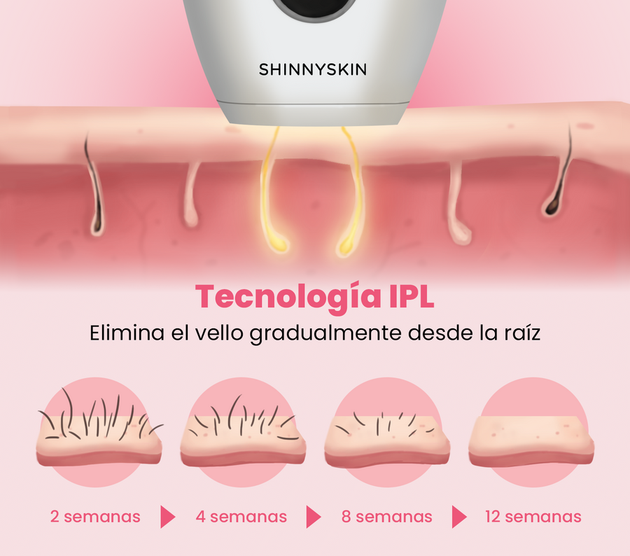 Depiladora Permanente IPL PRO