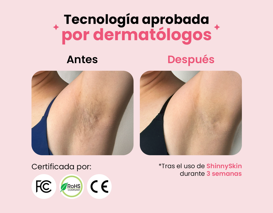Depiladora Permanente IPL clásica