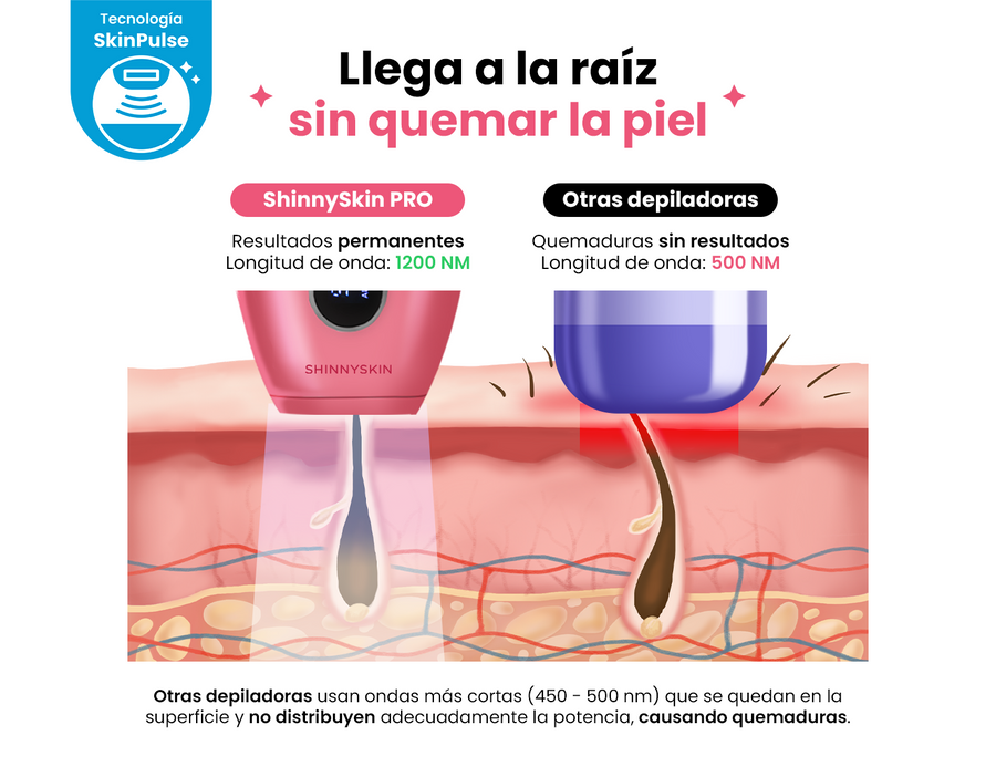 Depiladora Permanente IPL PRO