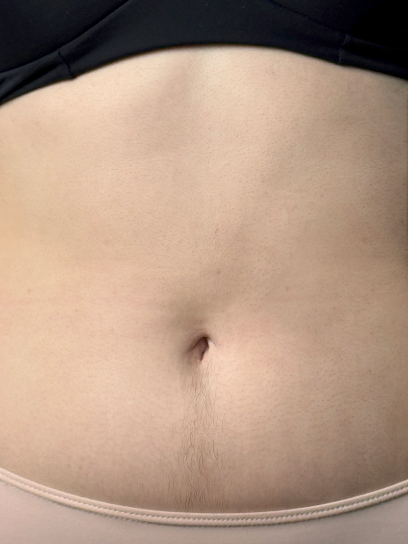 Abdomen 1