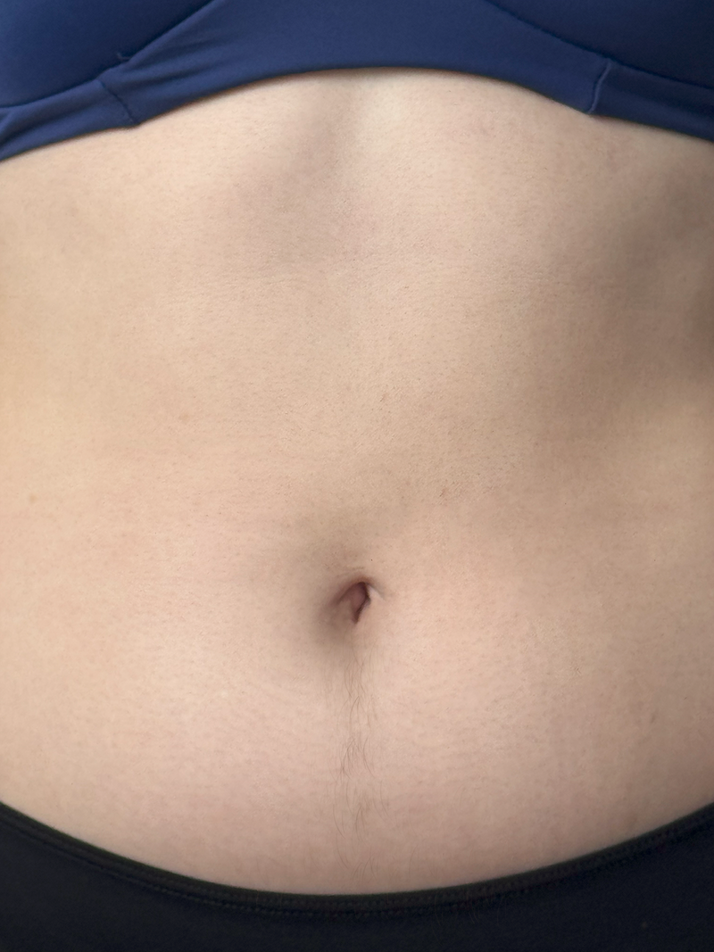Abdomen 2