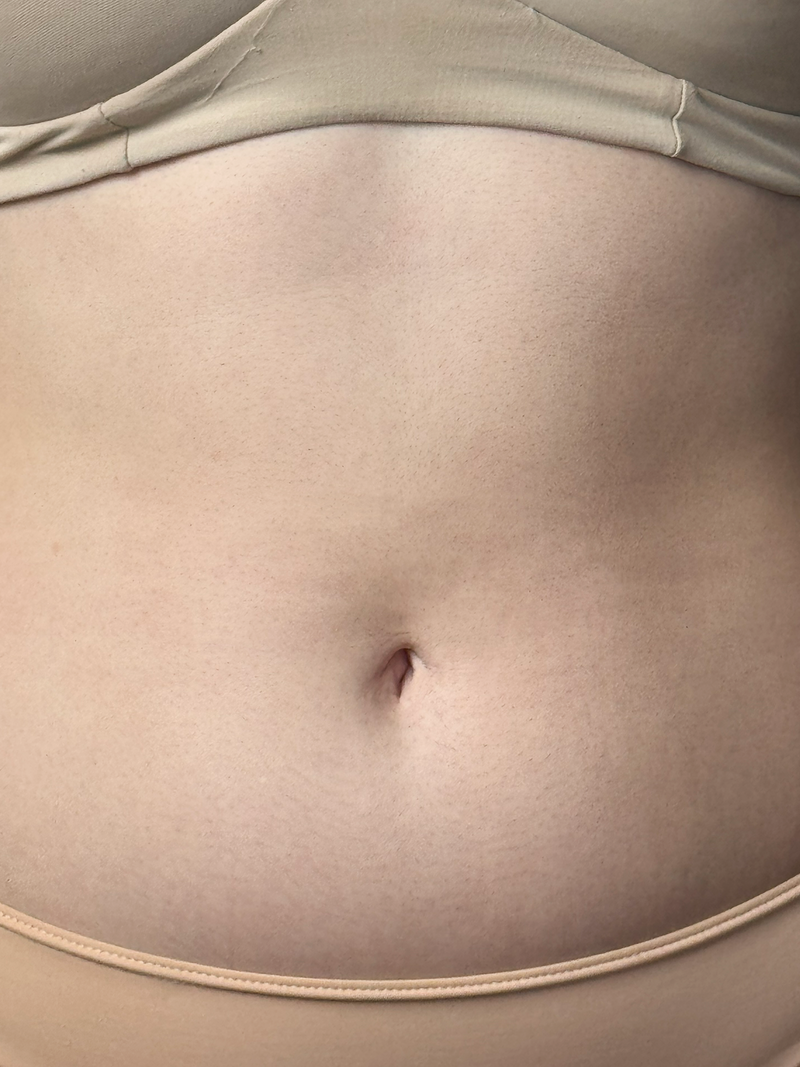 Abdomen 3