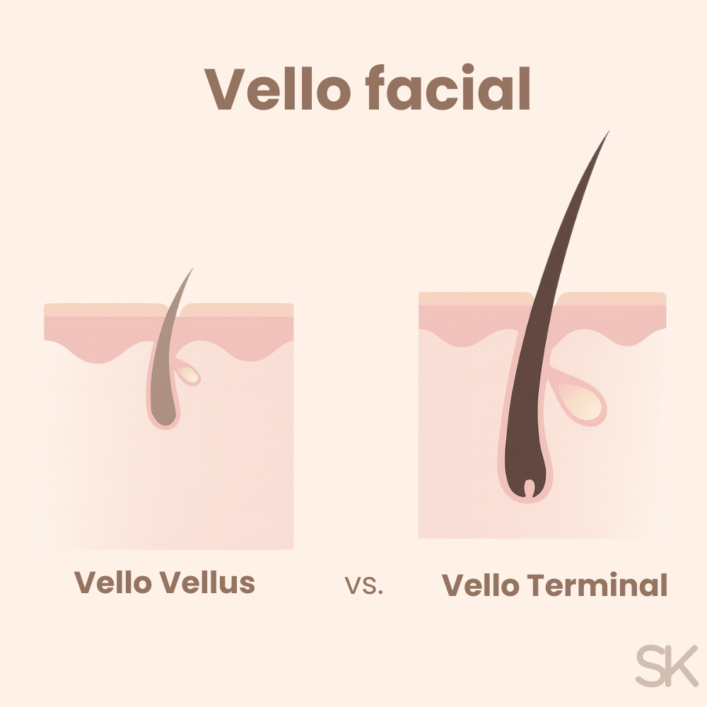 Ilustración de vello facial vellus vs vello terminal en la piel para explicar depilación facial con cuchilla