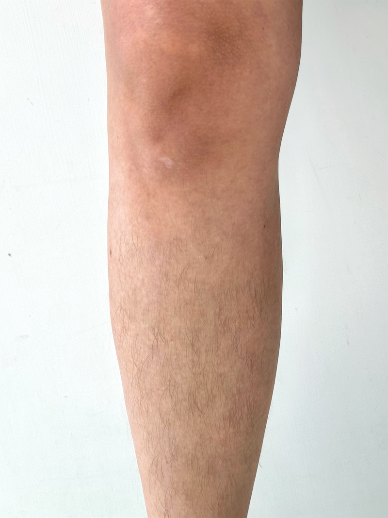 Piernas 1