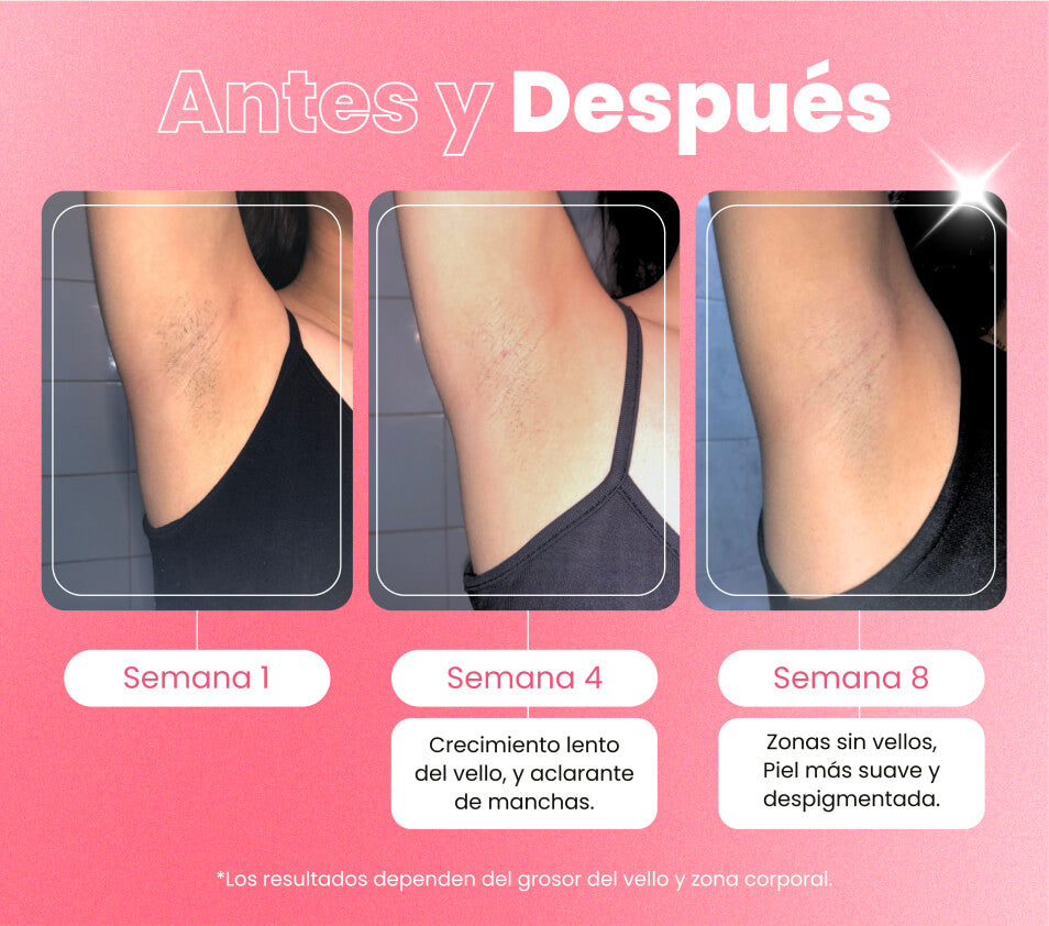 Mejor Depiladora Ipl Philips Depiladoras Laser En Casa Depiladoras